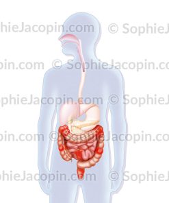 MALADIE DE CROHN